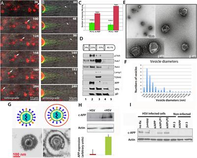 Herpes Simplex Virus, Alzheimer’s Disease and a Possible Role for Rab GTPases